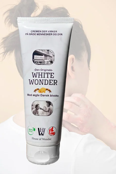 Dame med psoriasis bruger White Wonder